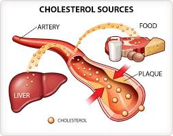 ldl cholesterol