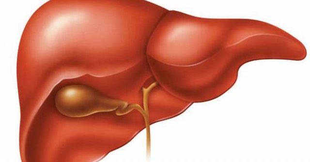 gan nhiễm mỡ, triệu chứng của gan nhiễm mỡ, gan nhiem mo